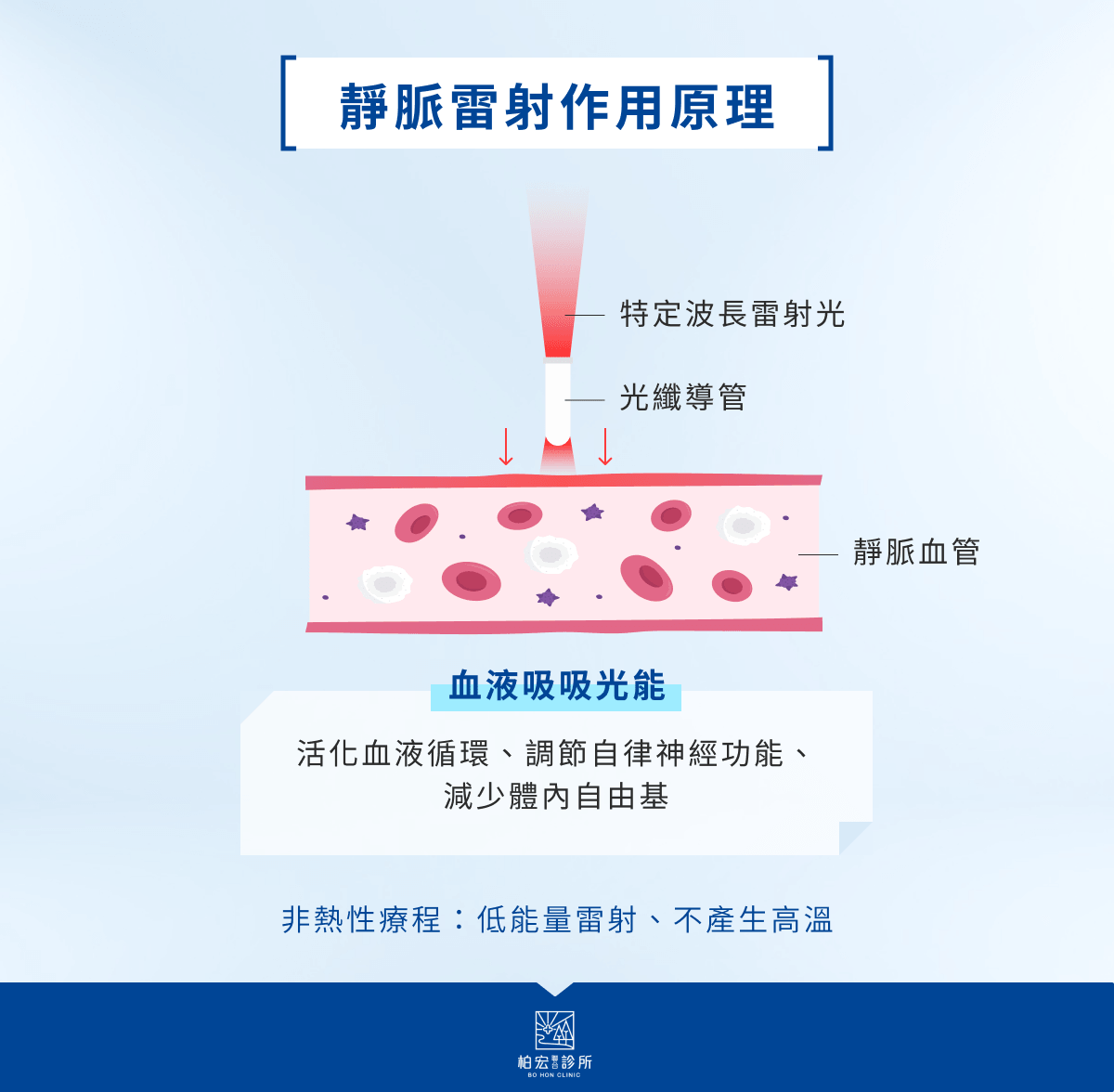 靜脈雷射作用原理